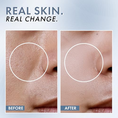 ThriveCo Niacinamide Serum with Zinc PCA | Reduces Acne Marks & Blemishes | Minimizes Pores | Oil Control Face Serum for Oily Skin | For Men & Women | 30ml - Image 6