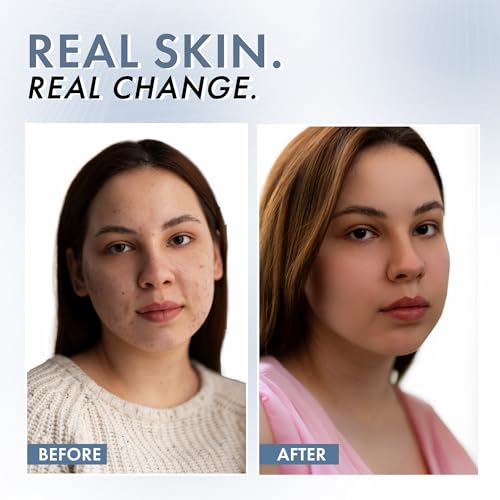 ThriveCo 10% Vitamin C Face Serum | Brightens Skin & Helps Reduce Dark Spots | With 33 kDa + 5 kDa Hyaluronic Acid | Boosts Hydration & Glow | For Men & Women | 30 ml - Image 5