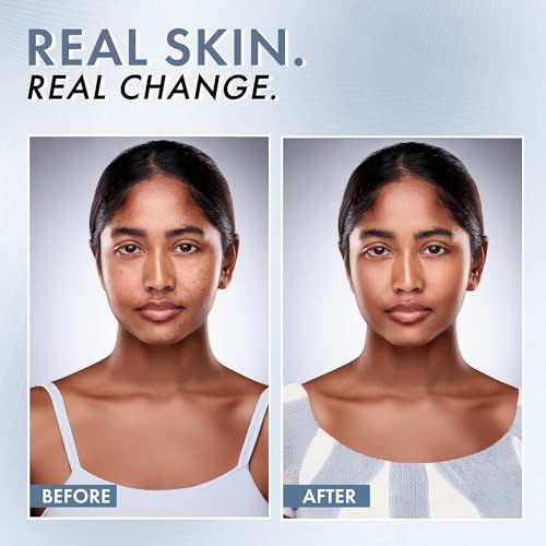 ThriveCo 10% Vitamin C Face Serum | Brightens Skin & Helps Reduce Dark Spots | With 33 kDa + 5 kDa Hyaluronic Acid | Boosts Hydration & Glow | For Men & Women | 30 ml - Image 6