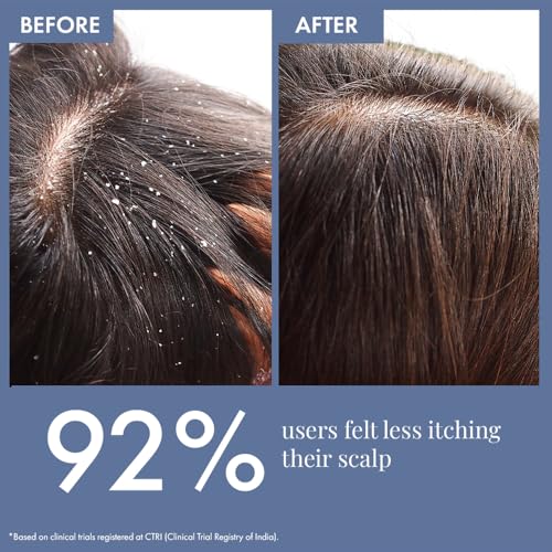 ThriveCo Anti Dandruff Scalp Clear