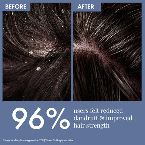 ThriveCo Anti Dandruff Scalp Clear