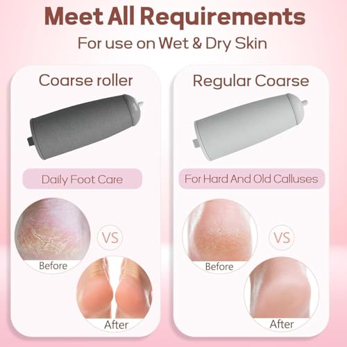 callus remover for feet dead