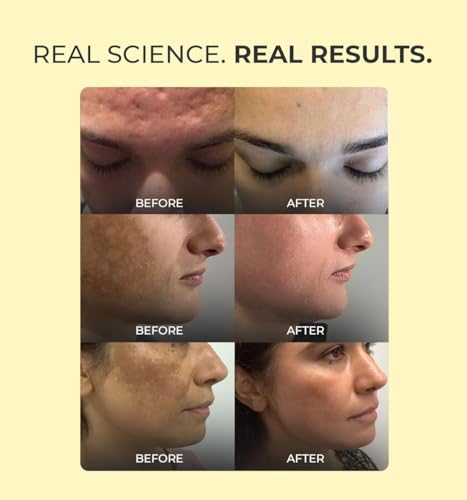 Aqueria Oil Control Brightening Gel