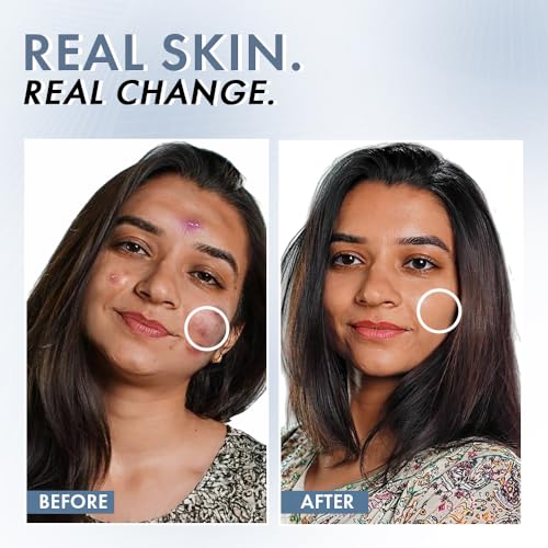 ThriveCo 2% Salicylic Acid Face