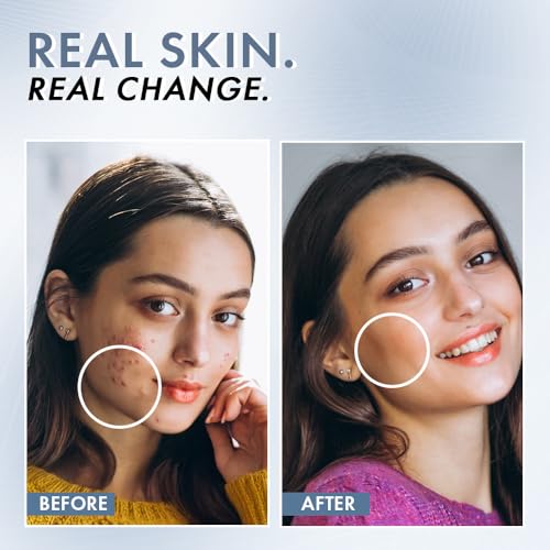 ThriveCo 2% Salicylic Acid Face
