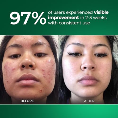 Aqueria Oil Control Brightening Gel