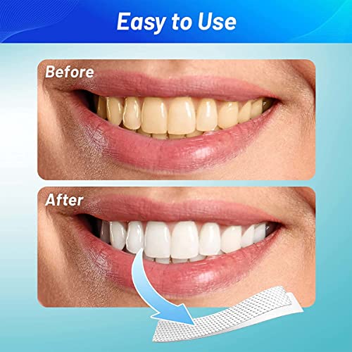 AGARO Dazzle Instant Teeth Whitening