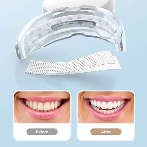 AGARO Dazzle Instant Teeth Whitening